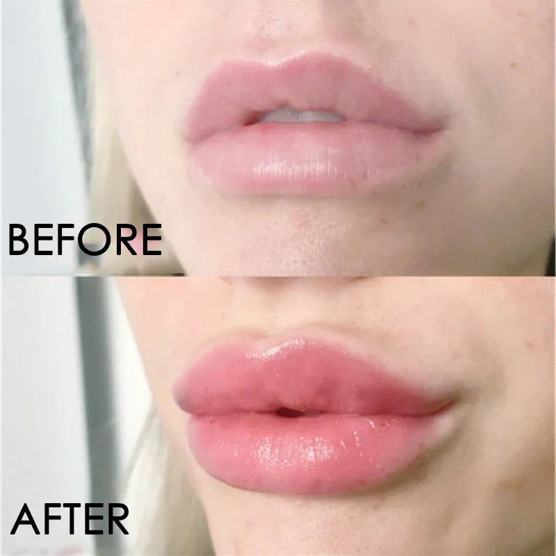 Serum Brilho Labial